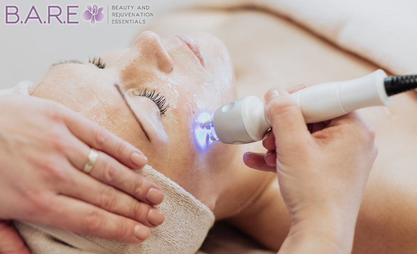 Laser skin tightening