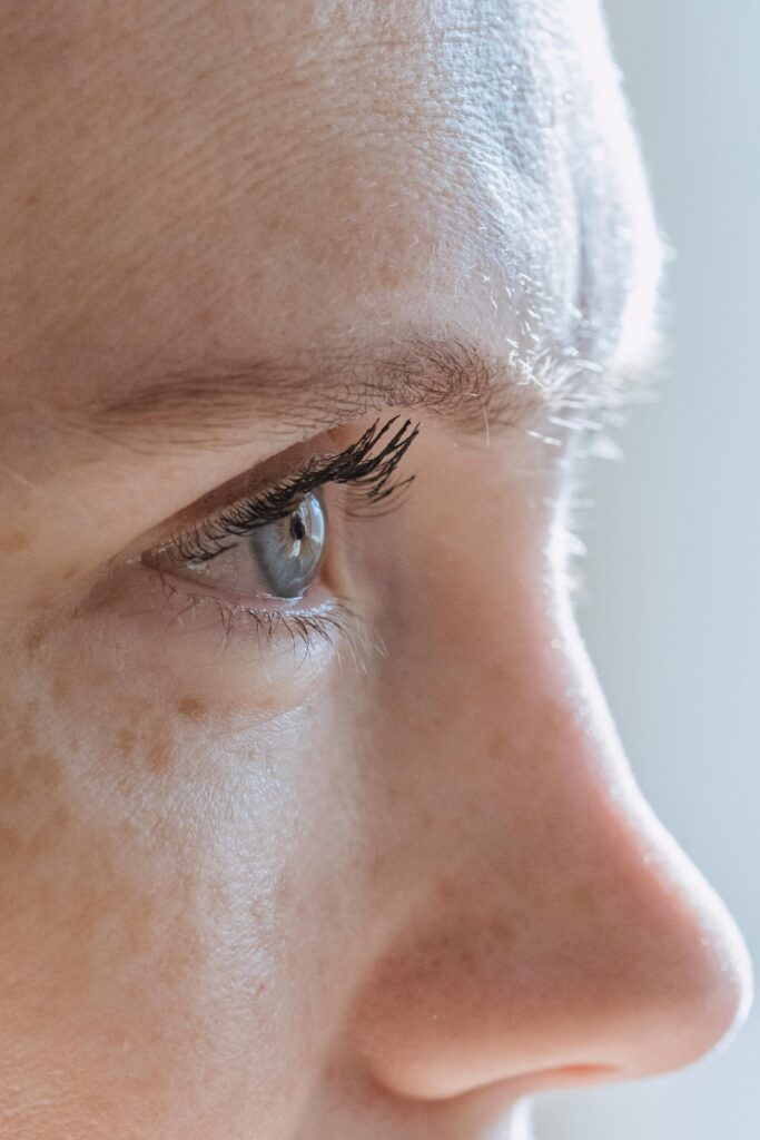 Female with freckles.