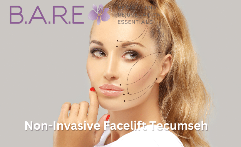 Non-Invasive Facelift Tecumseh